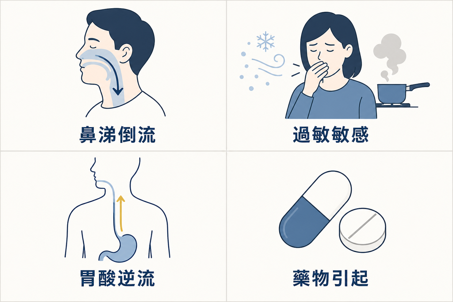 慢性咳嗽四大常見原因示意圖：鼻涕倒流、過敏與氣管敏感、胃食道逆流、藥物引起的咳嗽